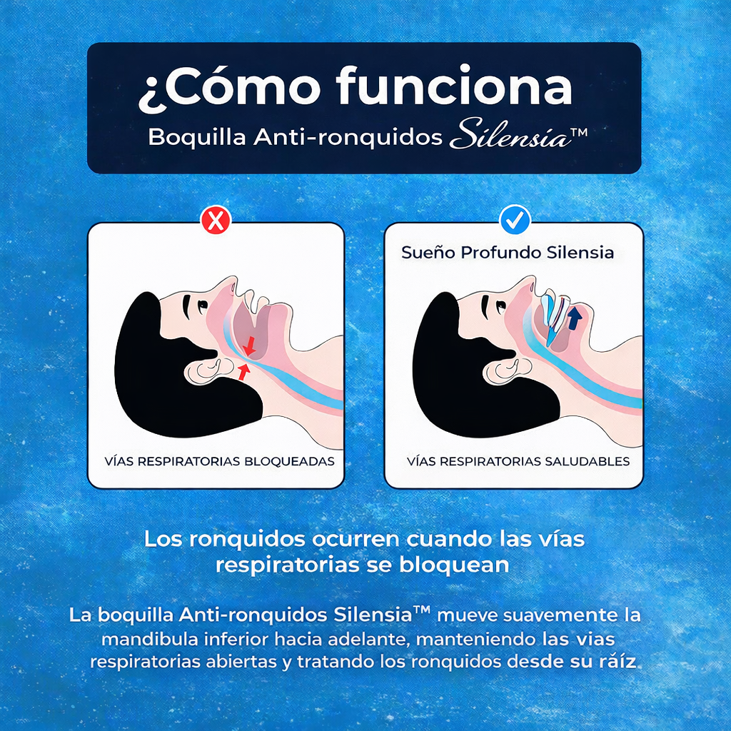 Silensia™ - Boquilla anti-ronquidos